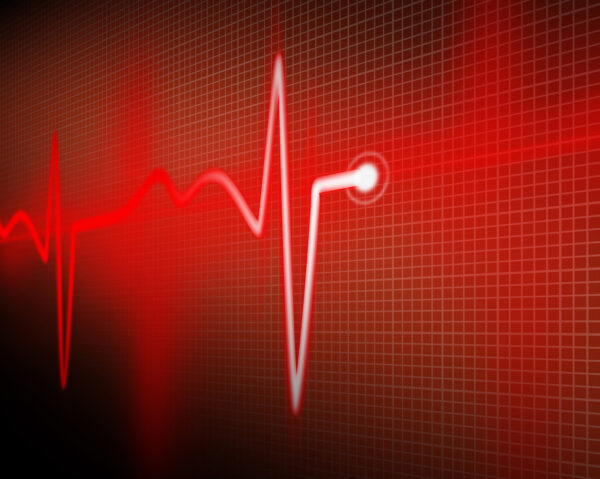 Πέντε συχνές ερωτήσεις για τον καρδιακό ρυθμό