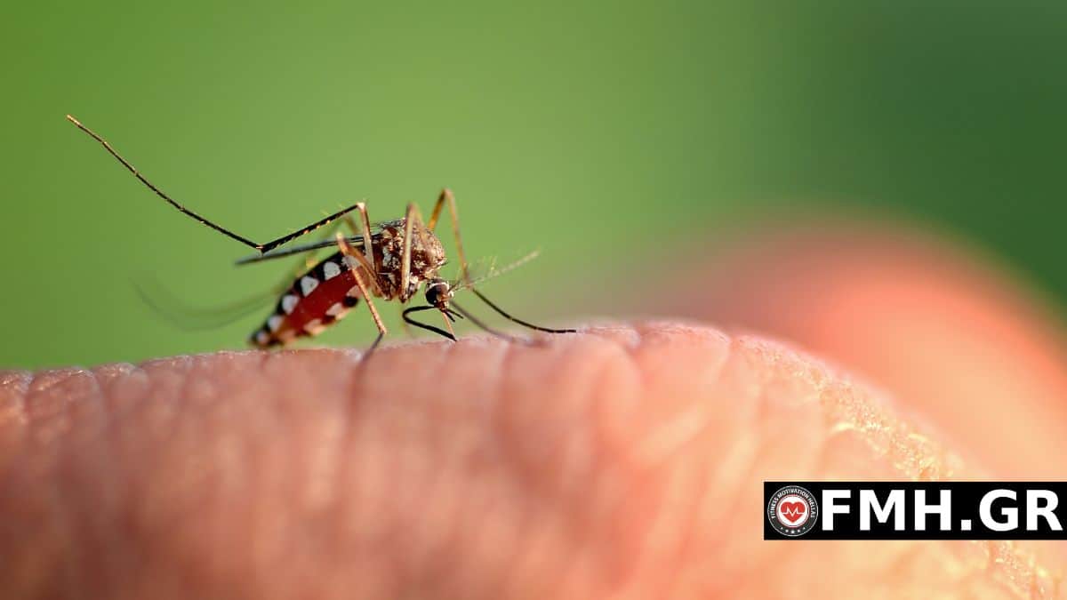 Τσίμπημα κουνουπιών: 7 τρόποι για να απαλλαγείτε